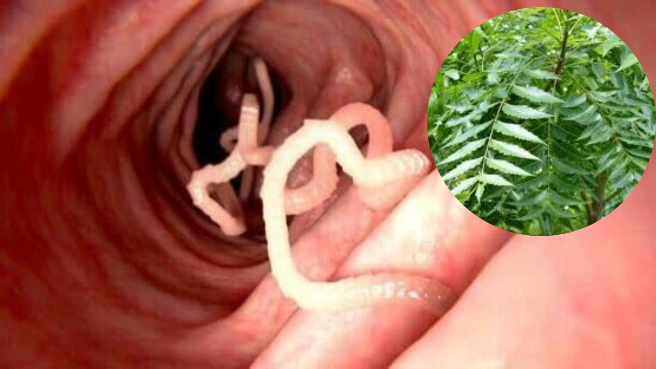 benefits of drinking neem juice on an empty stomach for Intestinal worms