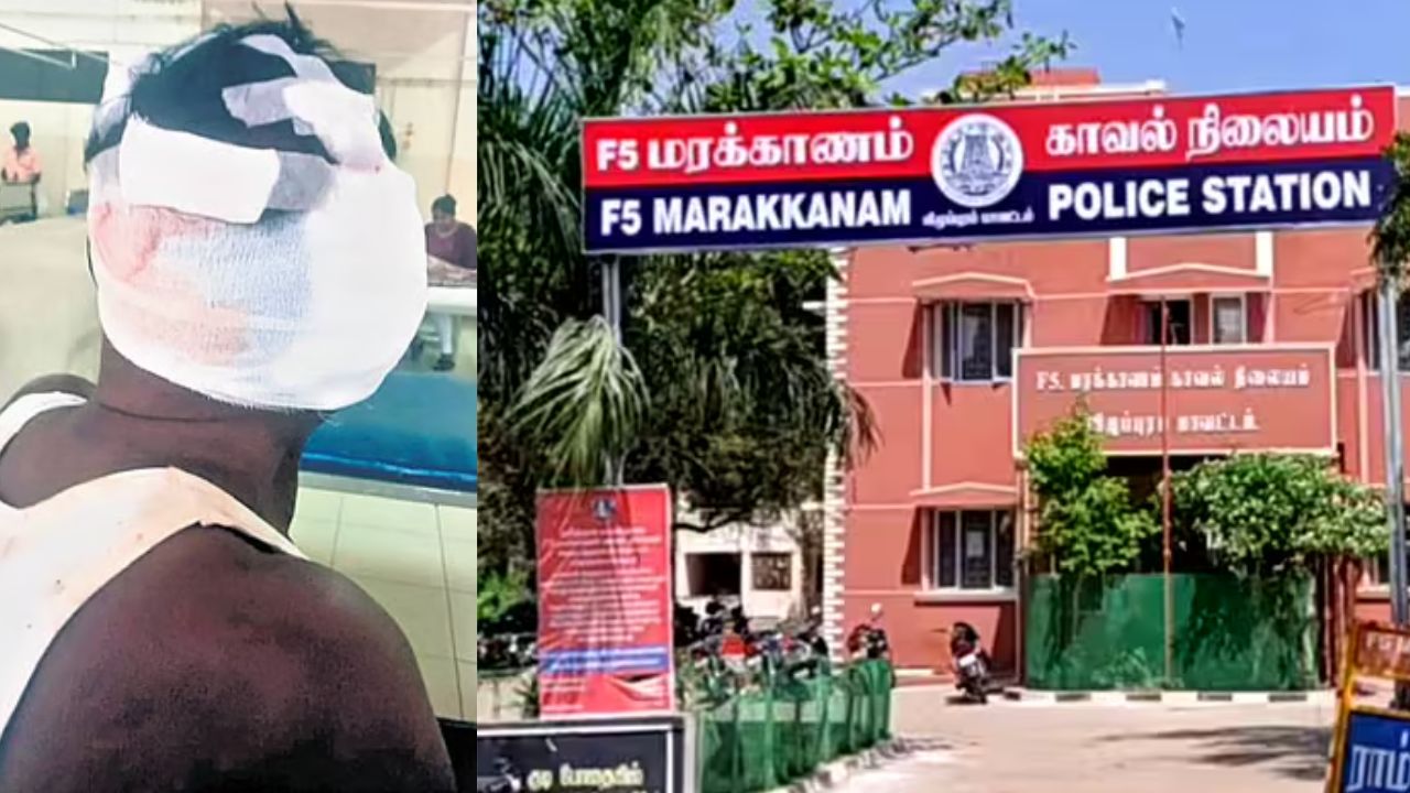 தி.மு.க. தொண்டர் காதறுப்பு
