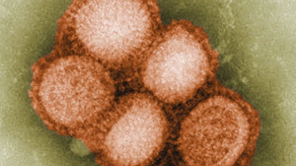 Swine Flu Guide