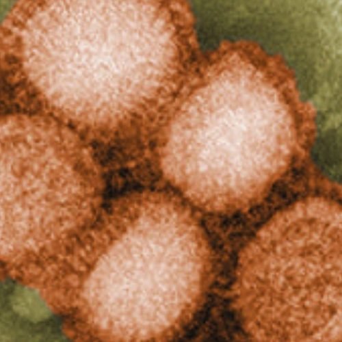 Swine Flu Guide